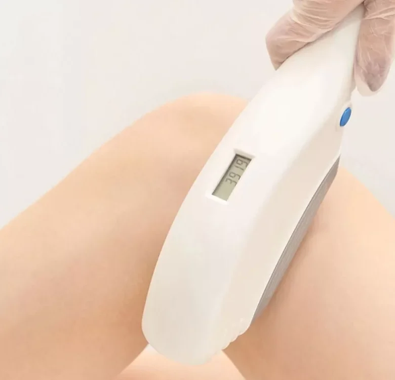 Laser Hair Removal in Islamabad