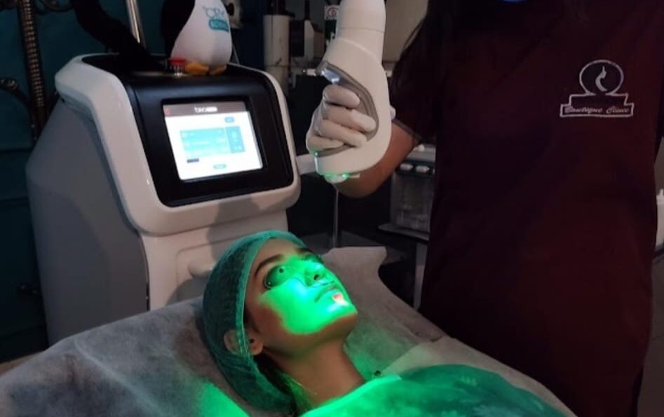 laser skin treatment