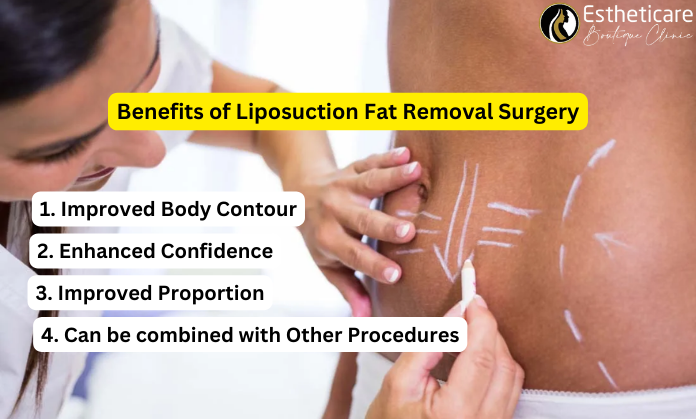 Benefits of Liposuction Fat Removal Surgery