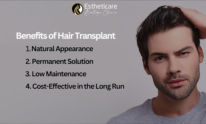 Benefits of Hair Transplant