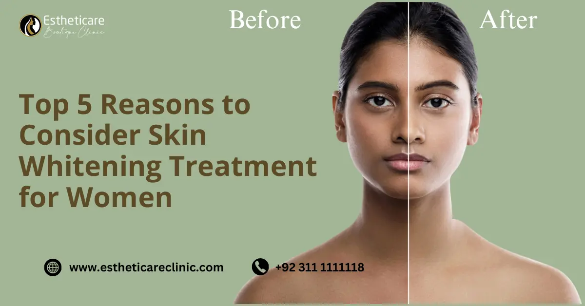 Top 5 Reasons to Consider Skin Whitening Treatment for Wome