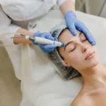 What Happens When You Get a HydraFacial After Laser Hair Removal?