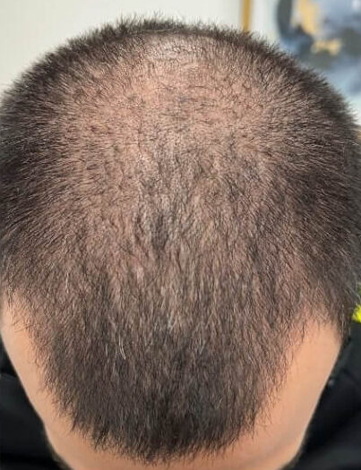 1 1030x1030 1 e1759703849560