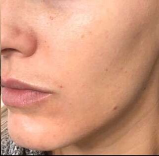 beauty booster e1760799751119