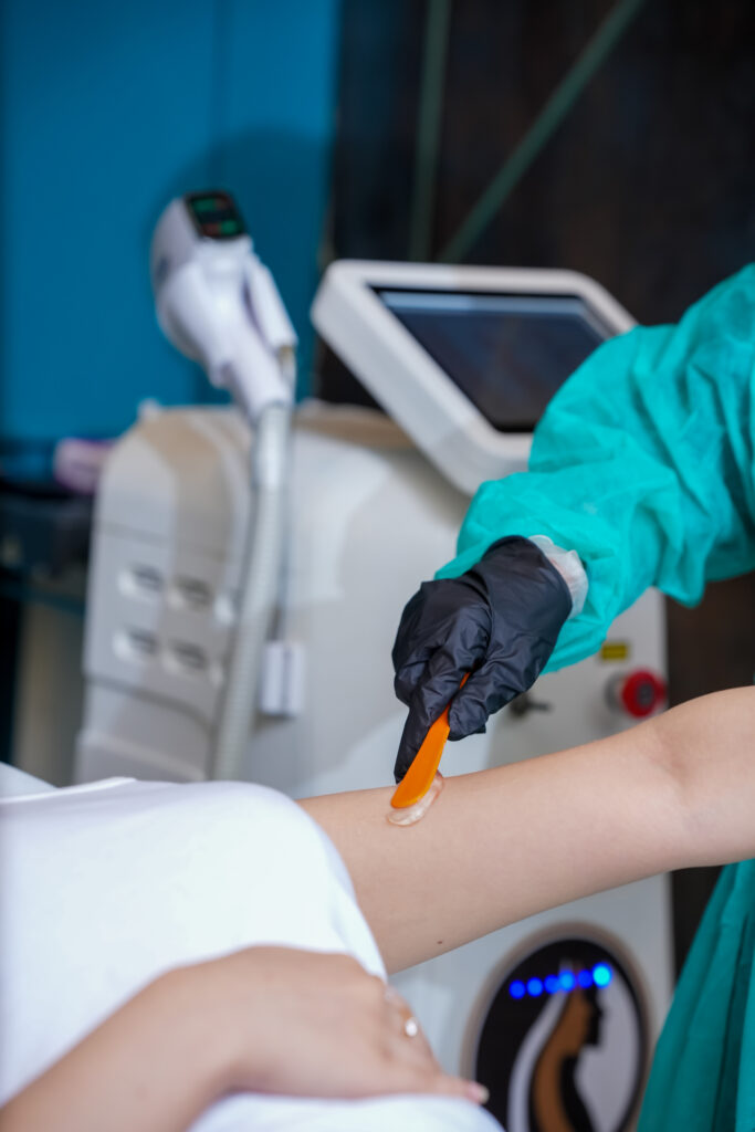 Laser Hair Removal in Islamabad