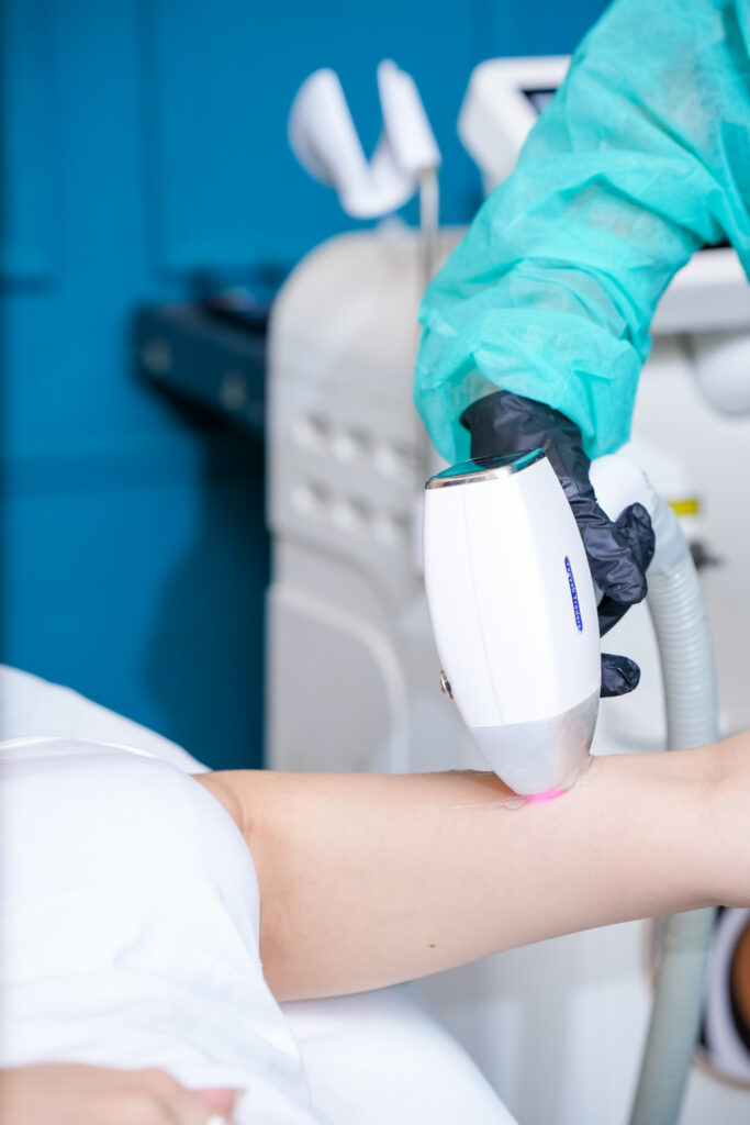 Laser Hair Removal in Islamabad